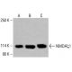 NMDAζ1抗體(F-10): sc-518053。Western blot分析HeLa(A)、K-562(B)及HCT-116(C)全細胞裂解液中NMDAζ1之表達。檢測試劑:m-IgG Fc BP-HRP:sc-525409。 NMDAζ1 Antibody (F-10) - Western Blotting - Image 416143