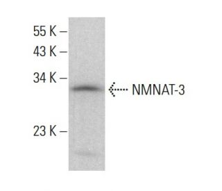 NMNAT-3 Antibody (D-10) - Western Blotting - Image 383795Each CRISPR/Cas9 Knockout (KO) Plasmid product consists of a pool of 3 plasmids designed to ensure identification and cleavage of a specific gene for maximum knockout efficiency. Each plasmid encodes a unique 20 nt sequence derived from the GeCKO (v2) library. 