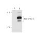 NNT-1/BSF-3 Antibody (985-1) - Western Blotting - Image 59317