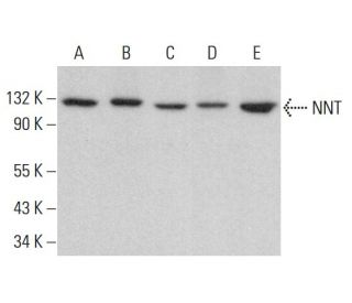 NNT Antibody (B-3) - Western Blotting - Image 383303
