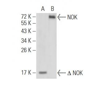 NOK Antibody (2H2F10) - Western Blotting - Image 137448