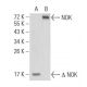 NOK Antibody (2H2F10) - Western Blotting - Image 137448