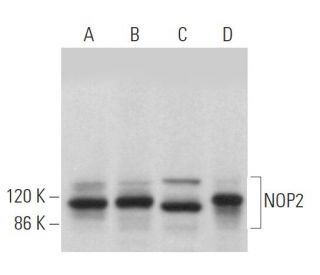 NOP2 Antibody (E-7) - Western Blotting - Image 368955 