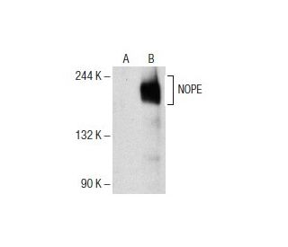 NOPE Antibody (27L-2) - Western Blotting - Image 154027
