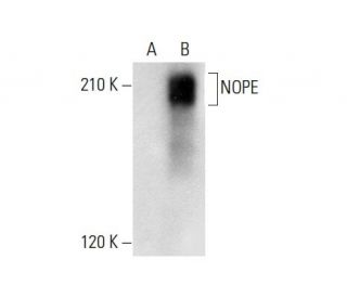 NOPE Antibody (A-10) - Western Blotting - Image 304513 