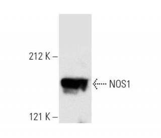 NOS1 Antibody (D-10) - Western Blotting - Image 3816 