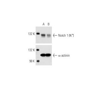 Notch 1 siRNA (h): sc-36095. Western blot analysis of Notch 1 expression in non-transfected control (A) and Notch 1 siRNA 