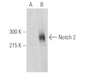 Notch 2 Antibody (C-2) - Western Blotting - Image 390035Each CRISPR/Cas9 Knockout (KO) Plasmid product consists of a pool of 3 plasmids designed to ensure identification and cleavage of a specific gene for maximum knockout efficiency. Each plasmid encodes a unique 20 nt sequence derived from the GeCKO (v2) library.