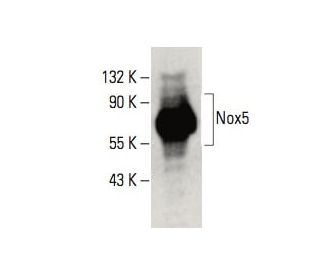 Nox5 Antibody (A-3) - Western Blotting - Image 395972SAM Transcription Activation: SAM system utilizing dCas9-VP64, MS2-P65-HSF1, and sgRNA for precise gene transcription activation.