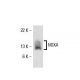 NOXA Antibody (114C307) - Western Blotting - Image 17686 