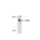 NOXA Antibody (114C307) - Western Blotting - Image 35425 