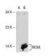 NOXA Antibody (114C307) - Western Blotting - Image 35429