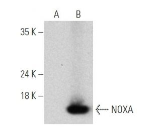 NOXA Antibody (F-3) - Western Blotting - Image 368575The Double Nickase Plasmid features a U6 promoter for sgRNA expression, a 20 nt targeting sequence, and a gRNA scaffold to guide Cas9n. It includes a CBh promoter for Cas9n (D10A) and puromycin resistance, GFP for transfection verification, and nuclear localization signals (NLS). The 2A peptide allows co-expression of Cas9n and Puro from a single promoter, enabling precise genome editing with reduced off-target effects.