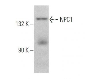 NPC1 Antibody (G-1) - Western Blotting - Image 369325Each CRISPR/Cas9 Knockout (KO) Plasmid product consists of a pool of 3 plasmids designed to ensure identification and cleavage of a specific gene for maximum knockout efficiency. Each plasmid encodes a unique 20 nt sequence derived from the GeCKO (v2) library.