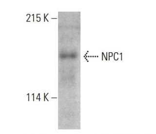 NPC1 Antibody (G-1) - Western Blotting - Image 387371Each CRISPR/Cas9 Knockout (KO) Plasmid product consists of a pool of 3 plasmids designed to ensure identification and cleavage of a specific gene for maximum knockout efficiency. Each plasmid encodes a unique 20 nt sequence derived from the GeCKO (v2) library.