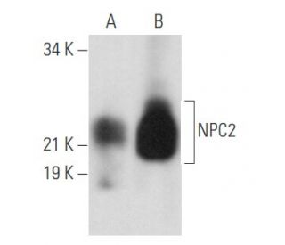 NPC2 Antibody (H-10) - Western Blotting - Image 357457 