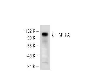 NPR-A Antibody (G-2) - Western Blotting - Image 55420 