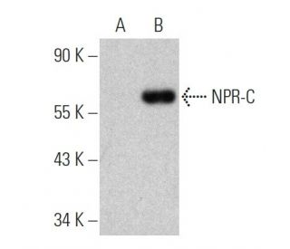 NPR-C Antibody (B-9) - Western Blotting - Image 360605