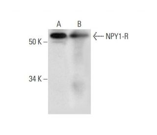 NPY1-R Antibody (E-4) - Western Blotting - Image 292993 