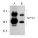 NPY1-R Antibody (E-4) - Western Blotting - Image 358657 