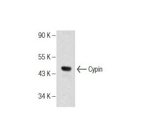 NRK Whole Cell Lysate: sc-364197. Western blot analysis of Cypin... 