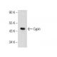 NRK Whole Cell Lysate: sc-364197. Western blot analysis of Cypin... 
