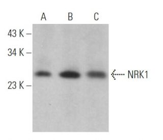 NRK1 Antibody (F-8) - Western Blotting - Image 370053 