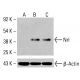 Anticorpo Nrl (A-6): sc-398046. Analisi Western blot dell'espressione di Nrl in lisati cellulari interi K-562 non trattati (A) e trattati chimicamente (B, C). Reagente di rilevamento utilizzato: m-IgG3 BP-HRP: sc-533670. β-Actina (C4): sc-47778 utilizzata come controllo di caricamento. Reagente di rilevamento utilizzato: m-IgG Fc BP-HRP: sc-525409. Nrl Antibody (A-6) - Western Blotting - Image 415364