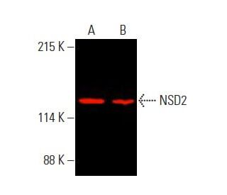 NSD2 Antibody (G-12) - Western Blotting - Image 396044