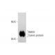 NSD3 Antibody (2E9) - Western Blotting - Image 136633