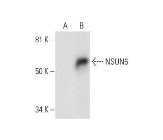 NSUN6 Antibody (D-5) - Western Blotting - Image 295871 