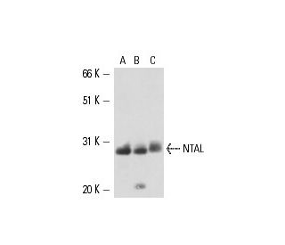 NTAL Antibody (6D620) - Western Blotting - Image 16139 