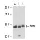 NTAL Antibody (6D620) - Western Blotting - Image 16139 