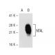 NTAL Antibody (6D620) - Western Blotting - Image 43916 