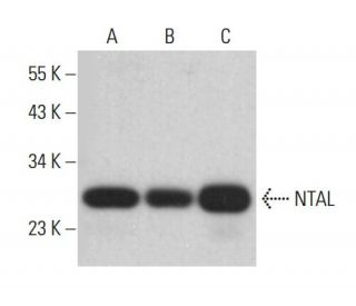 NTAL Antibody (D-7) - Western Blotting - Image 382621 