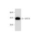 NTERA-2 cl.D1 Whole Cell Lysate: sc-364181. Western blot analysis of... 