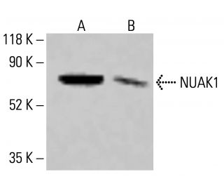 NUAK1/ARK5 Antibody (A-9) - Western Blotting - Image 414129