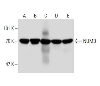 NUMB Antibody (48) - Western Blotting - Image 144680 