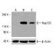 ARHGAP39(D-6)抗体:sc-515231。通过蛋白质印迹分析HeLa(A)、K-562(B)和HCT-116(C)完整细胞裂解液中ARHGAP39的表达。使用的检测试剂: m-IgG1 BP-HRP:sc-525408。 Nup133 Antibody (G-11) - Western Blotting - Image 415965