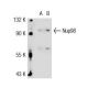 Nup98 Antibody (2H10) - Western Blotting - Image 33410 