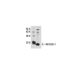NY-ESO-1 Antibody (6A146) - Western Blotting - Image 18117 