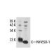 NY-ESO-1 Antibody (6A146) - Western Blotting - Image 18117 