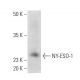 NY-ESO-1 Antibody (6A146) - Western Blotting - Image 353675
