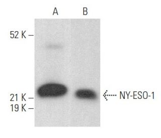 NY-ESO-1 Antibody (E978) - Western Blotting - Image 353989 