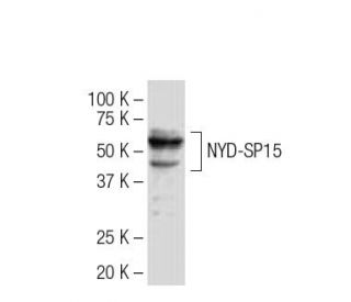 NYD-SP15 Antibody (3C8) - Western Blotting - Image 33648 