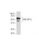 NYD-SP15 Antibody (3C8) - Western Blotting - Image 33648 