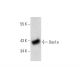Oas1a Antibody (C-8) - Western Blotting - Image 139456 