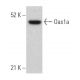 Oas1a Antibody (C-8) - Western Blotting - Image 366812