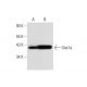 Oas1a Antibody (E-2) - Western Blotting - Image 143590 