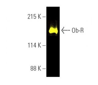Ob-R/Leptin Receptor Antibody (B-3) - Western Blotting - Image 391046The Double Nickase Plasmid features a U6 promoter for sgRNA expression, a 20 nt targeting sequence, and a gRNA scaffold to guide Cas9n. It includes a CBh promoter for Cas9n (D10A) and puromycin resistance, GFP for transfection verification, and nuclear localization signals (NLS). The 2A peptide allows co-expression of Cas9n and Puro from a single promoter, enabling precise genome editing with reduced off-target effects.